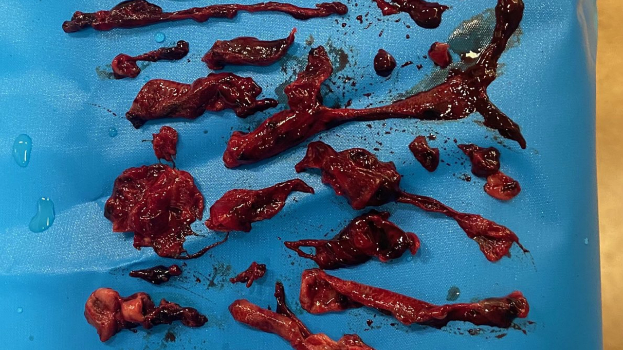 Koronavirüsün verdiği hasarı en iyi gösteren kare!