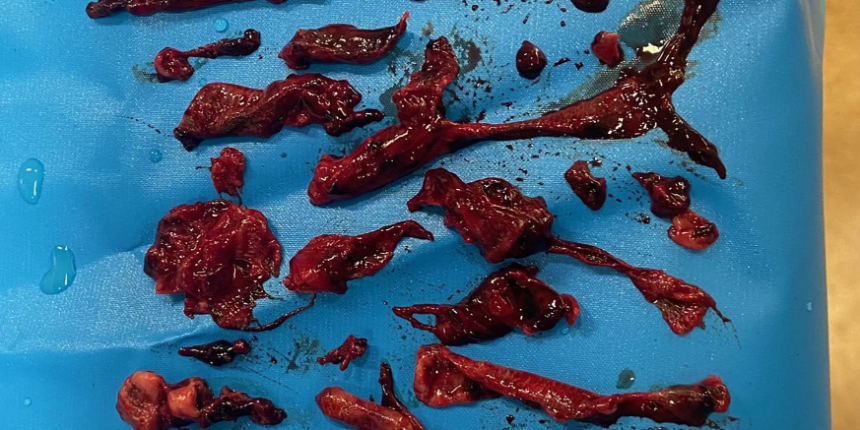 Koronavirüsün verdiği hasarı en iyi gösteren kare!