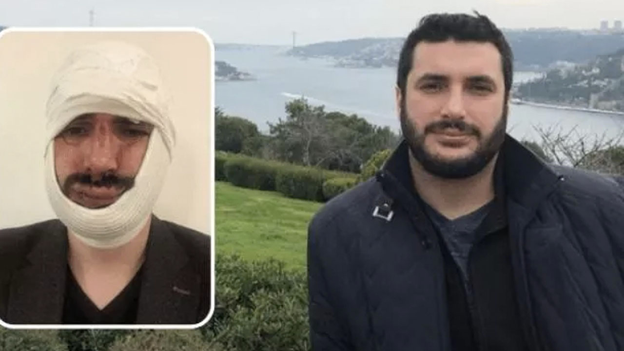 Anadolu Ajansı muhabirine saldırı: 2 kişi serbest bırakıldı