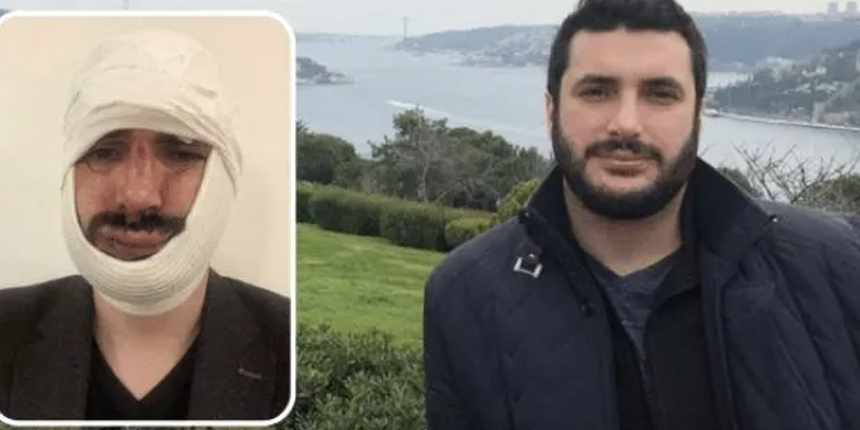 Anadolu Ajansı muhabirine saldırı: 2 kişi serbest bırakıldı