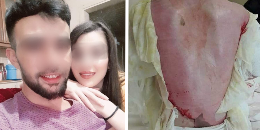 Eşinin bebeğiyle birlikte kaynar suyla yaktığı kadın feryat etti: Ölmek istemiyorum