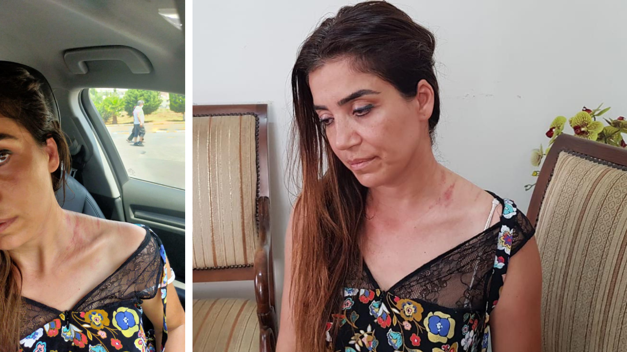 Muayenehanede birbirlerine girdiler! Doktoru boynundan tırmaladı