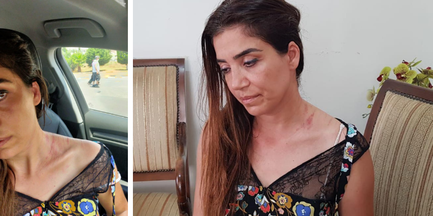 Muayenehanede birbirlerine girdiler! Doktoru boynundan tırmaladı