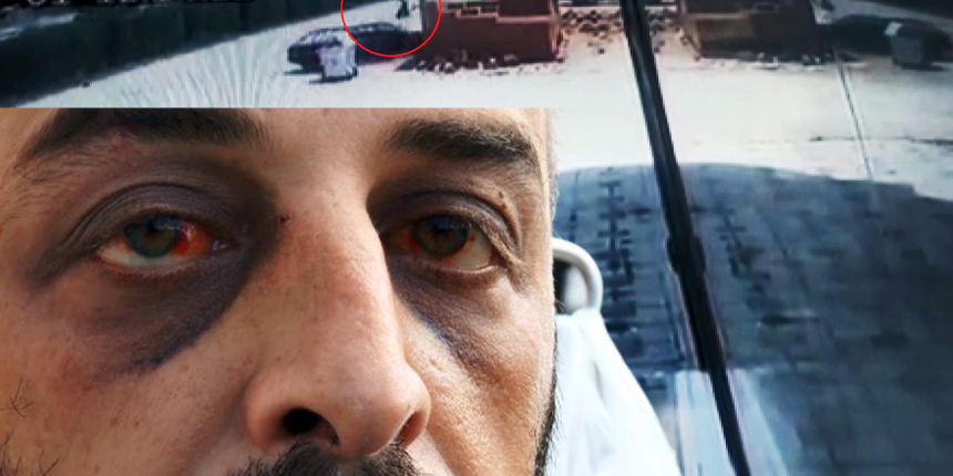 Eski sevgilisinin ailesi önce arabayla çarptı sonra öldüresiye dövdü! 'Öldü' diyerek bıraktılar