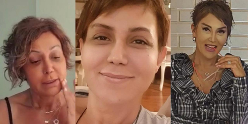 Serap Paköz'ün inanılmaz değişimi! Estetik sonrası son halini paylaştı