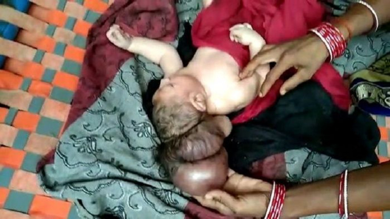 Üç başlı doğan bebek şoke etti! Vatandaşlar 'tanrı' diyerek tapmaya başladı!