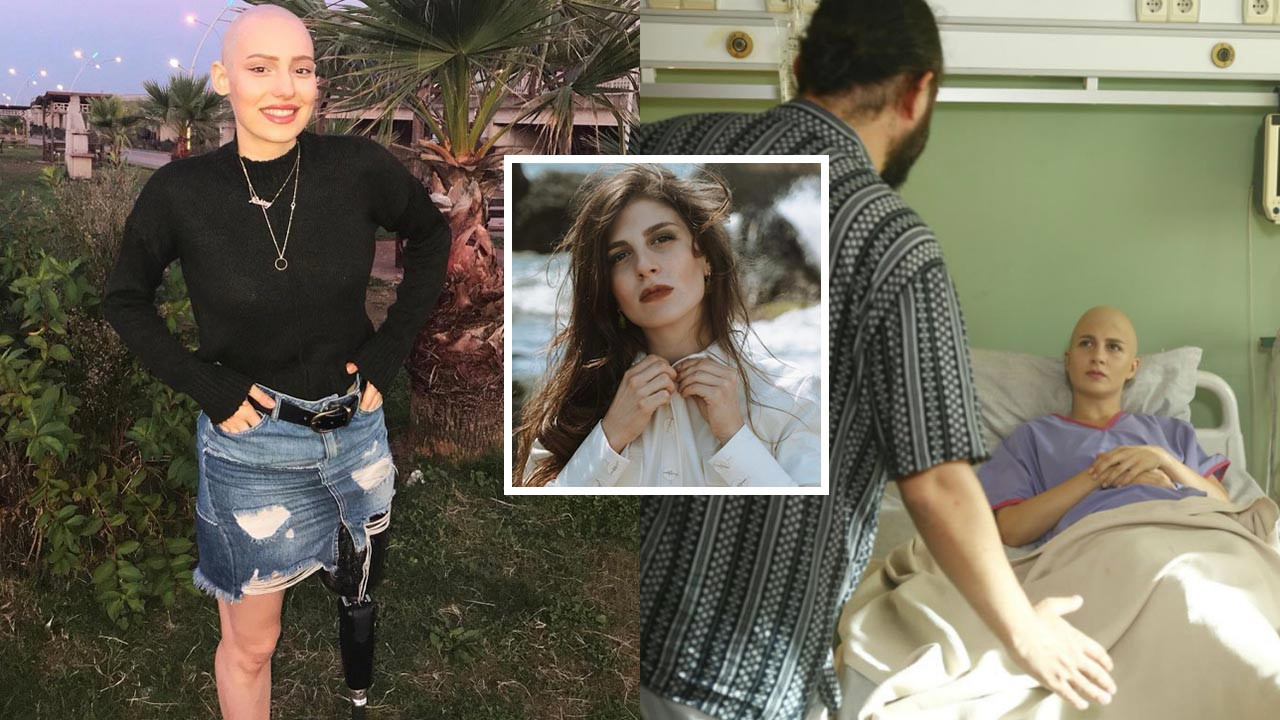 Neslican Tay'ın hayatını canlandıran Kırgın Çiçekler’in Kader’i Naz Çağla Irmak saçlarını kazıttı! Artık peruk kullanacak