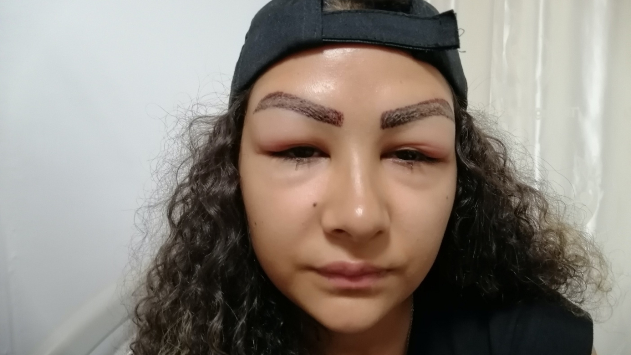 Reklam yüzü olmak isterken yüzünden oldu