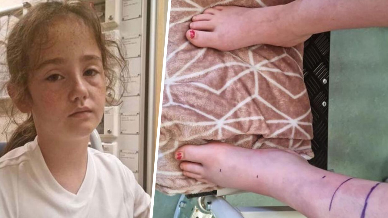 Doktorlar gözlerine inanamadı: Böylesini daha önce görmedik!