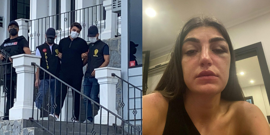 Ünlü manken Gizem Akbaş'ı öldüresiye döven eski sevgilisinin ilk sözleri bakın ne oldu