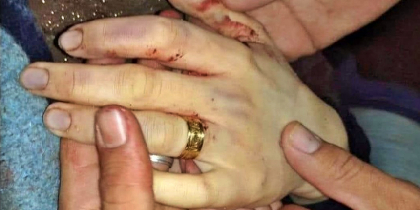 Esad bombalarıyla ölen genç kadının acı öyküsü!