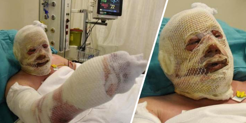 Alevlerin arasında kalan kahraman ormancı: Bir cesaret geldi koşmaya başladım!