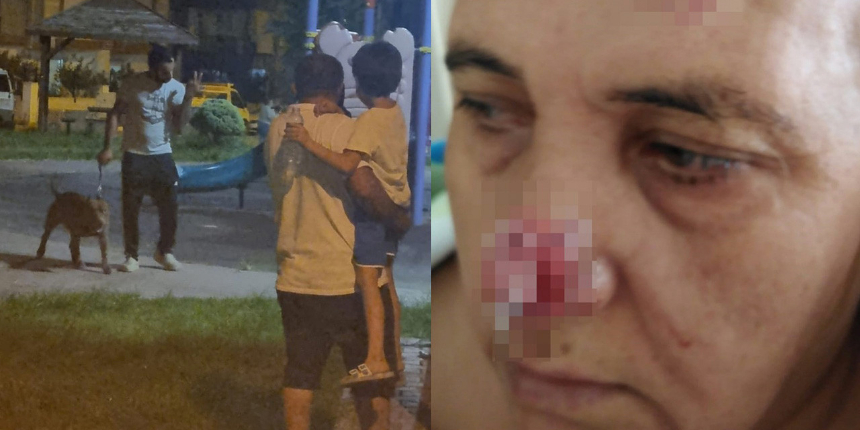 Antalya'da pitbull cinsi köpek 55 yaşındaki kadına saldırdı! Burnu koptu...
