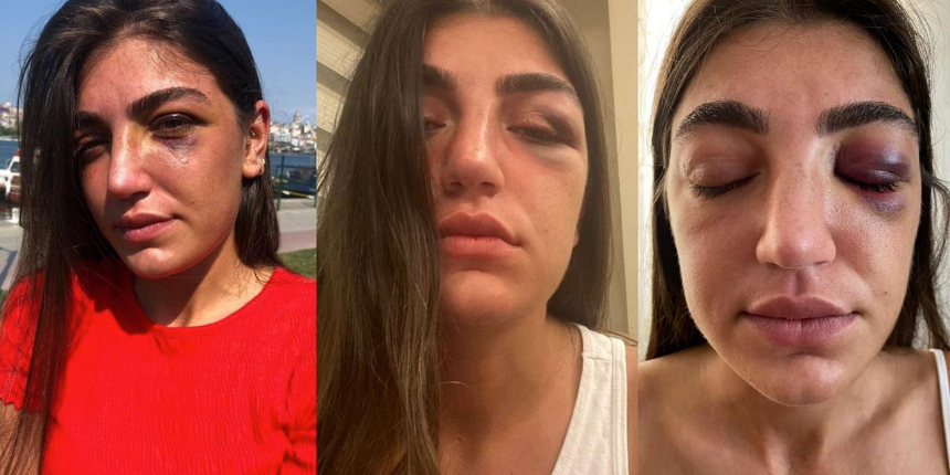 Öldüresiye dövmüştü! Manken Gizem Akbaş saplantılı eski sevgilisinin tahliyesine isyan etti