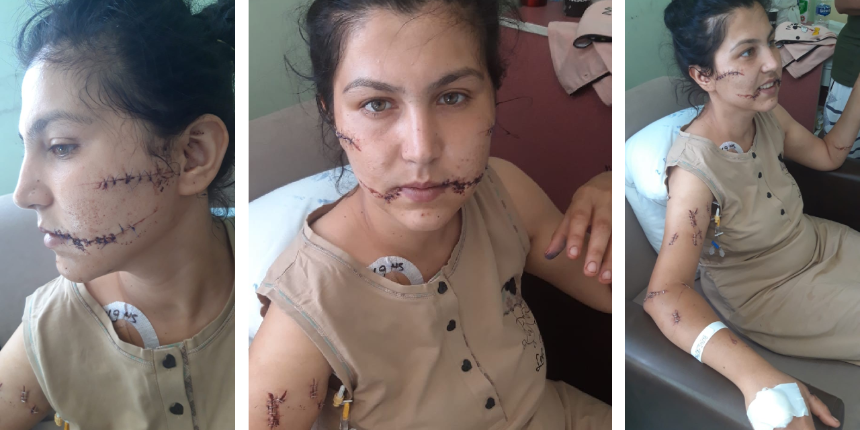 Eşi banyoya kilitleyip 100 yerinden bıçakladı! Dehşet anlarını anlattı