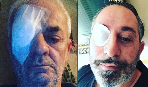 Doğum gününde Cem Yılmaz'ın gözüne bakın ne oldu!