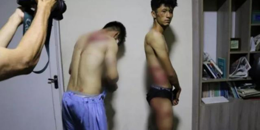 Taliban'dan tüyler ürperten işkence! Kadınları çeken gazeteciler 4 saat boyunca kırbaçlandı!