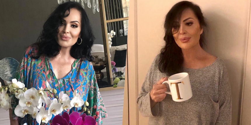 Estetik yaptıran Türkan Şoray'ın yüzündeki değişim sosyal medyayı salladı