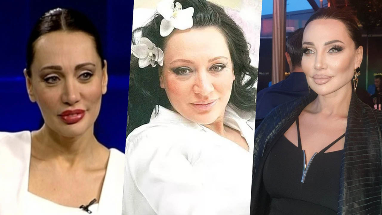 Türkiye'nin Angelina Jolie'si Umut Akyürek estetiği abarttı! Gün geçtikçe gençleşiyor
