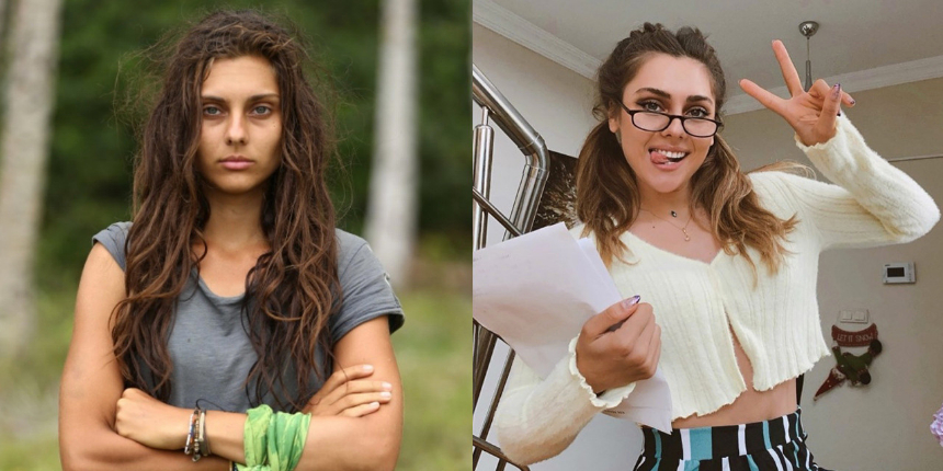 Survivor'daki halini unutun! Tuğçe Melis Demir estetik operasyonlarla bambaşka birine dönüştü