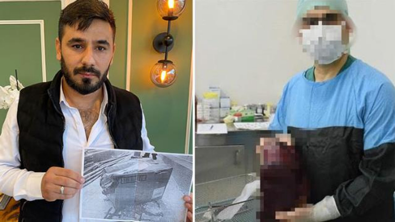 'Kayıp dalak' olayında flaş gelişme! Hastaneye şaka gibi bir ceza verildi...