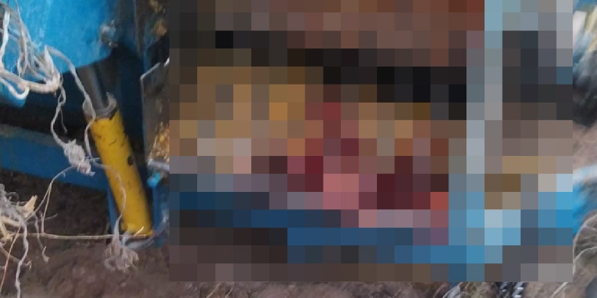 Kabak çekme makinesine düşen kadının ayakları koptu