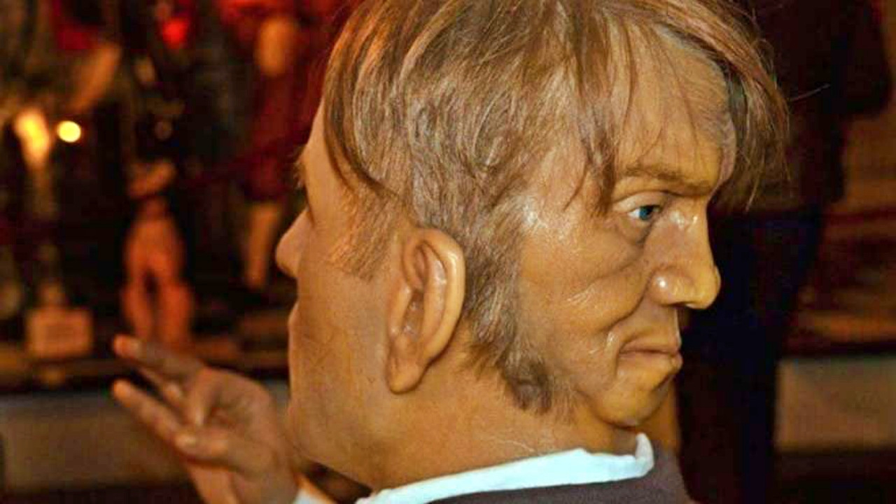 Dünya yeniden onu konuşmaya başladı! Kafasının arkasında başka bir yüzle doğdu!