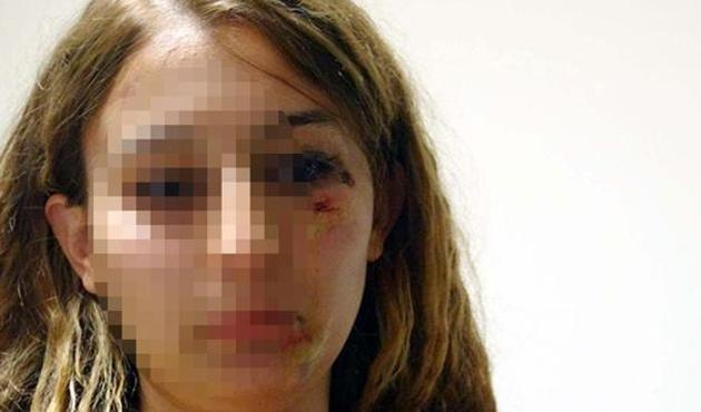 Kadın polise kuaförde feci dayak!