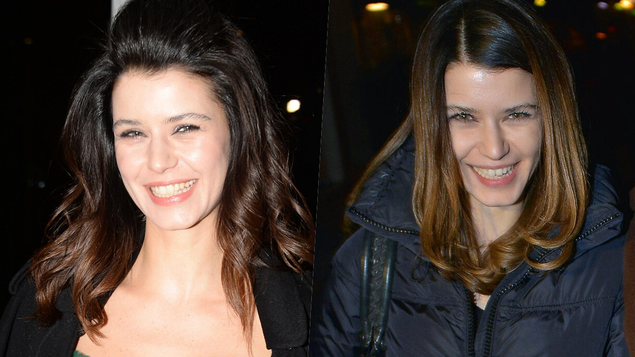 Dişlerini yaptıran Beren Saat'in yeni hali sosyal medyayı salladı
