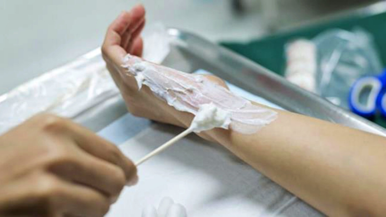 Sadist amcadan inanılmaz ceza! 10 yaşındaki yeğeninin elini, yüzünü ve ayaklarını kızgın kaşıkla yaktı!