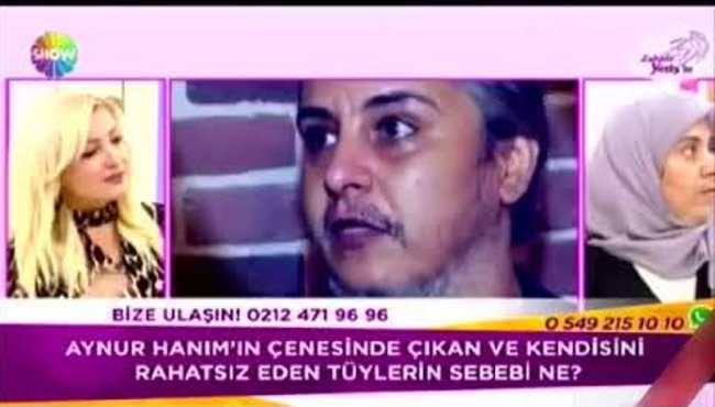 Zahide Yetiş'e çıkan sakallı kadın milyonları şoke etti! / VİDEO
