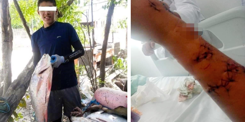 Denizde dehşet! 14 yaşındaki çocuk kolunu ısıran köpekbalığından burnunu sıkarak kurtuldu