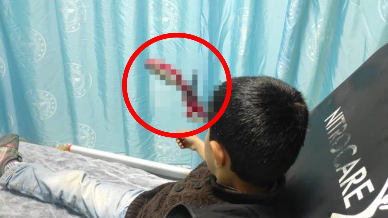 Böyle şaka olmaz olsun! Hastaneye kafasında makasla geldi...