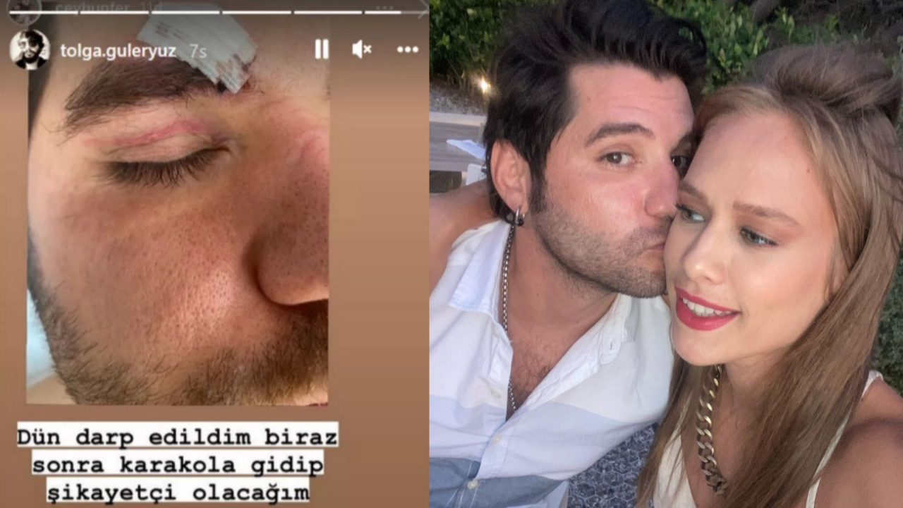Saldırıya uğrayan Ceyhun Fersoy ve eşi Begüm Öner'den açıklama