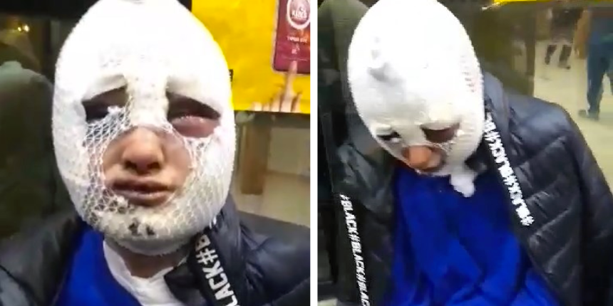 Eski sözlüsünün evini bastı, tecavüz etti, başından aşağı kızgın yağ döktü!