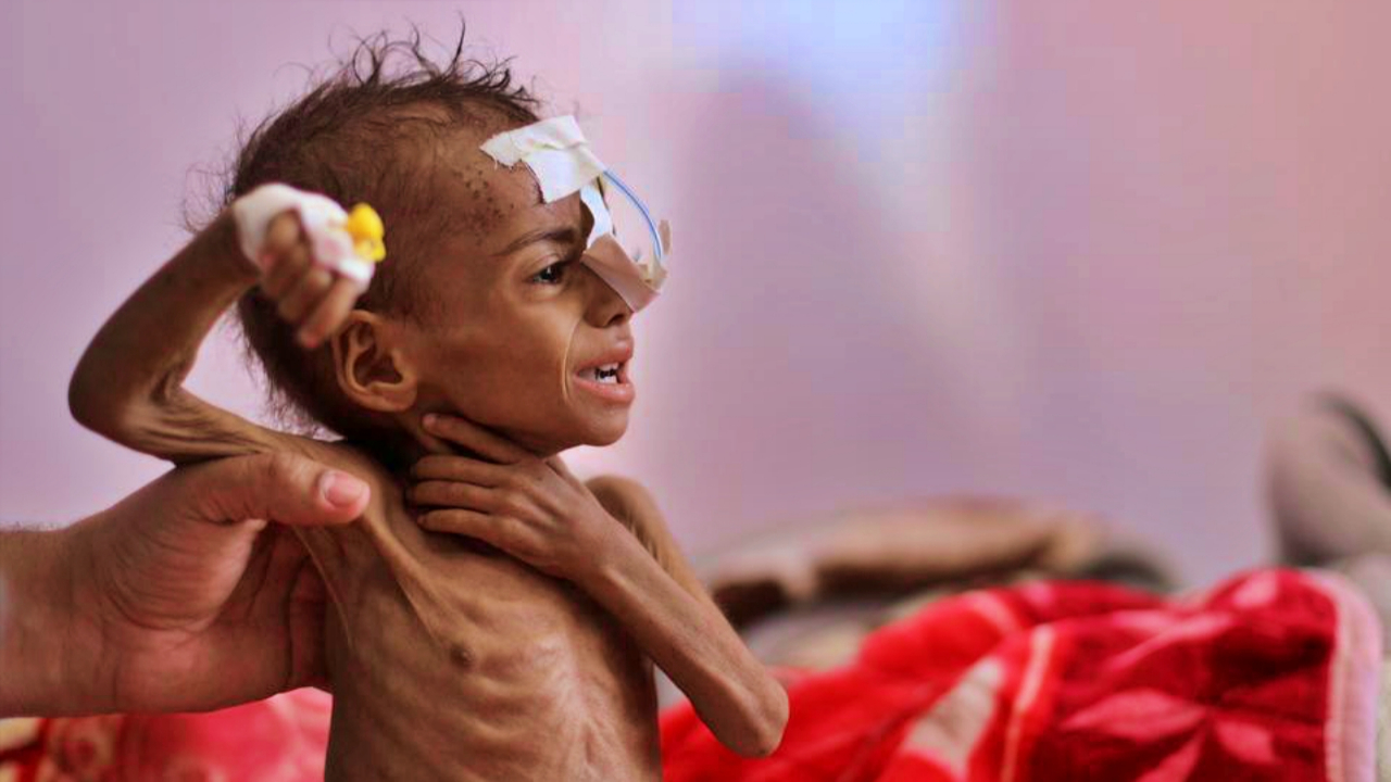 BM Dünya Gıda Programı: Fonumuz azaldı, Yemen'e gıda yardımını kestik!