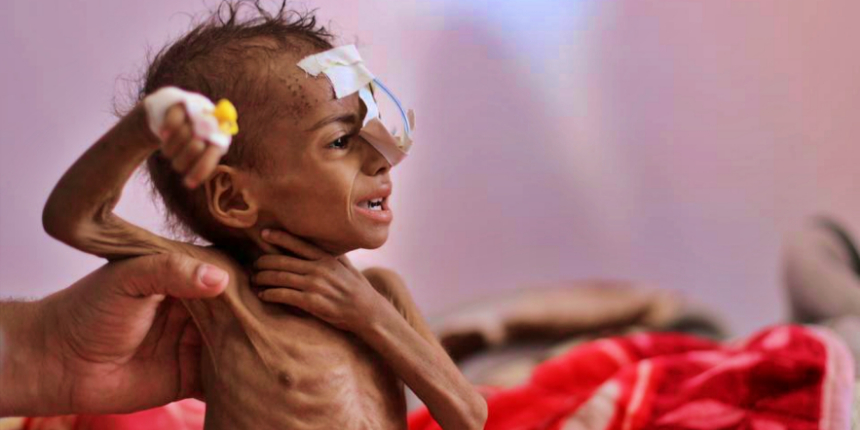 BM Dünya Gıda Programı: Fonumuz azaldı, Yemen'e gıda yardımını kestik!