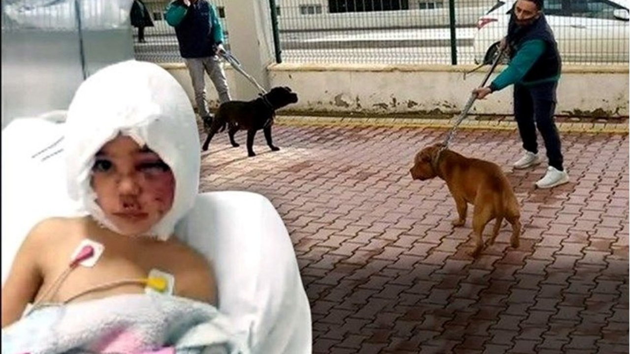 Pitbull saldırısına uğrayan Asiye Ateş'ten kahreden haber: Bir daha duyamayabilir!