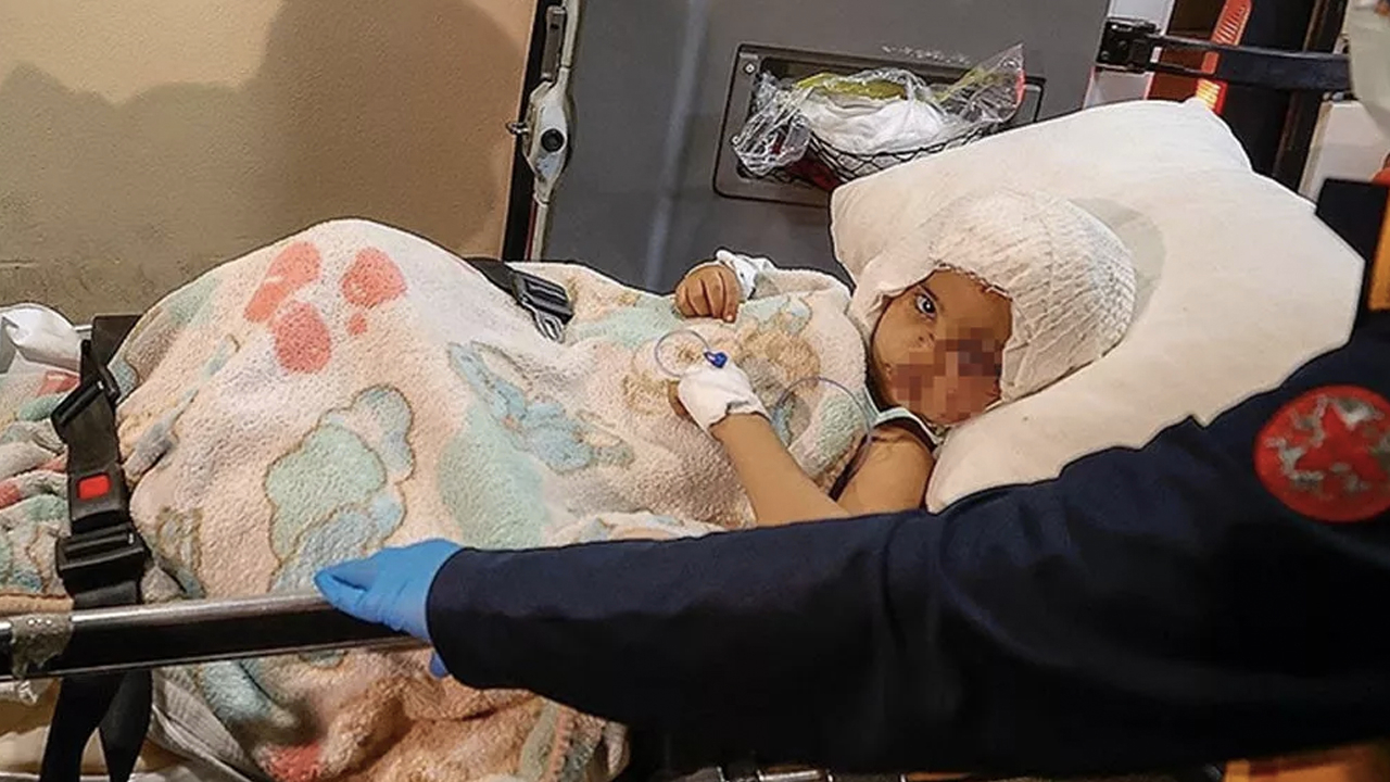 Pitbull saldırısına uğrayan Asiye'ye doku nakli uygulandı: Annesine sorduğu soru ortaya çıktı