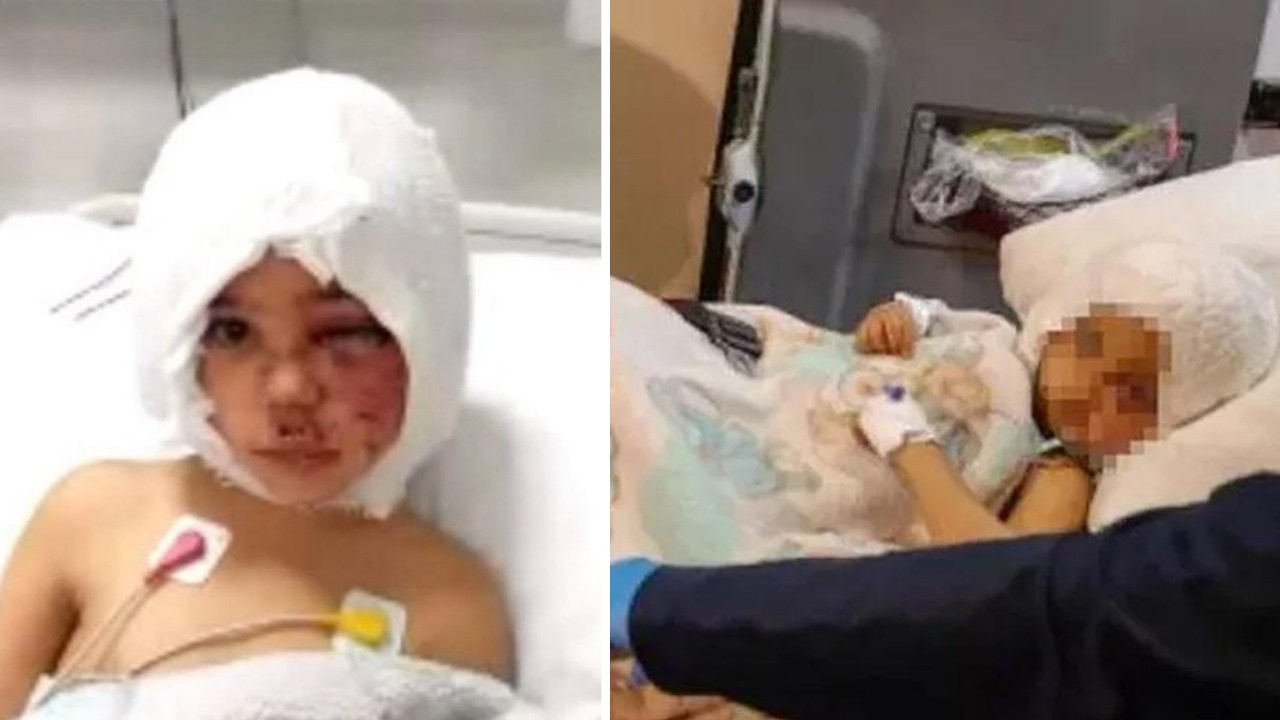 Pitbull saldırısına uğrayan minik Asiye uyanmaya başladı: Mırıldanarak bir şeyler söyledi!