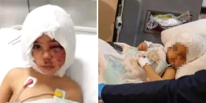 Pitbull saldırısına uğrayan minik Asiye uyanmaya başladı: Mırıldanarak bir şeyler söyledi!