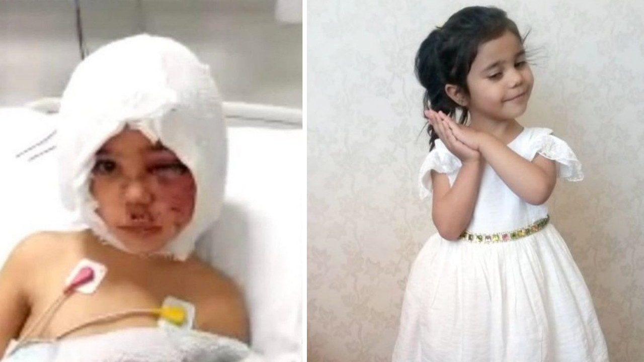 Pitbull saldırısına uğrayan Asiye Ateş'ten güzel haber: Doktoru duyurdu!