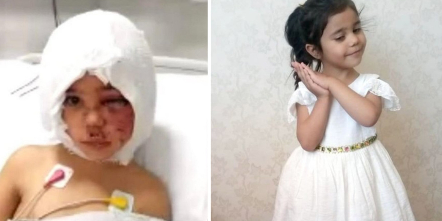 Pitbull saldırısına uğrayan Asiye Ateş'ten güzel haber: Doktoru duyurdu!