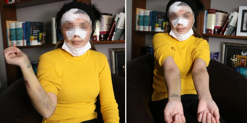 "Erkekle otele girdi" iddiası sonrası bıçaklanmıştı! Olay aslında bambaşkaymış...