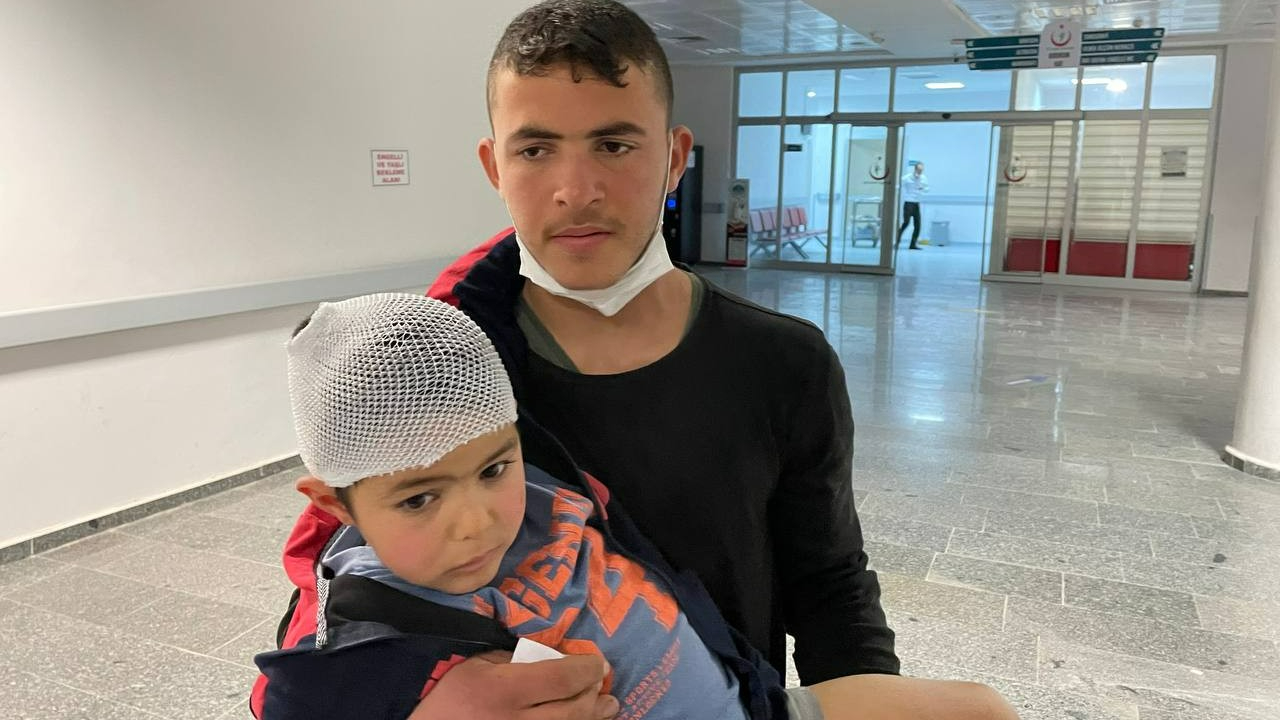 Aksaray'da sokak köpeklerinin saldırdığı çocuk yaralandı