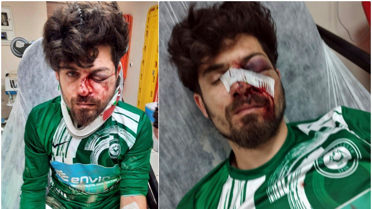 Kırmızı kart gören futbolcudan cinayete teşebbüs! Amatör futbolcu Umut Karakaş tedavi altında...