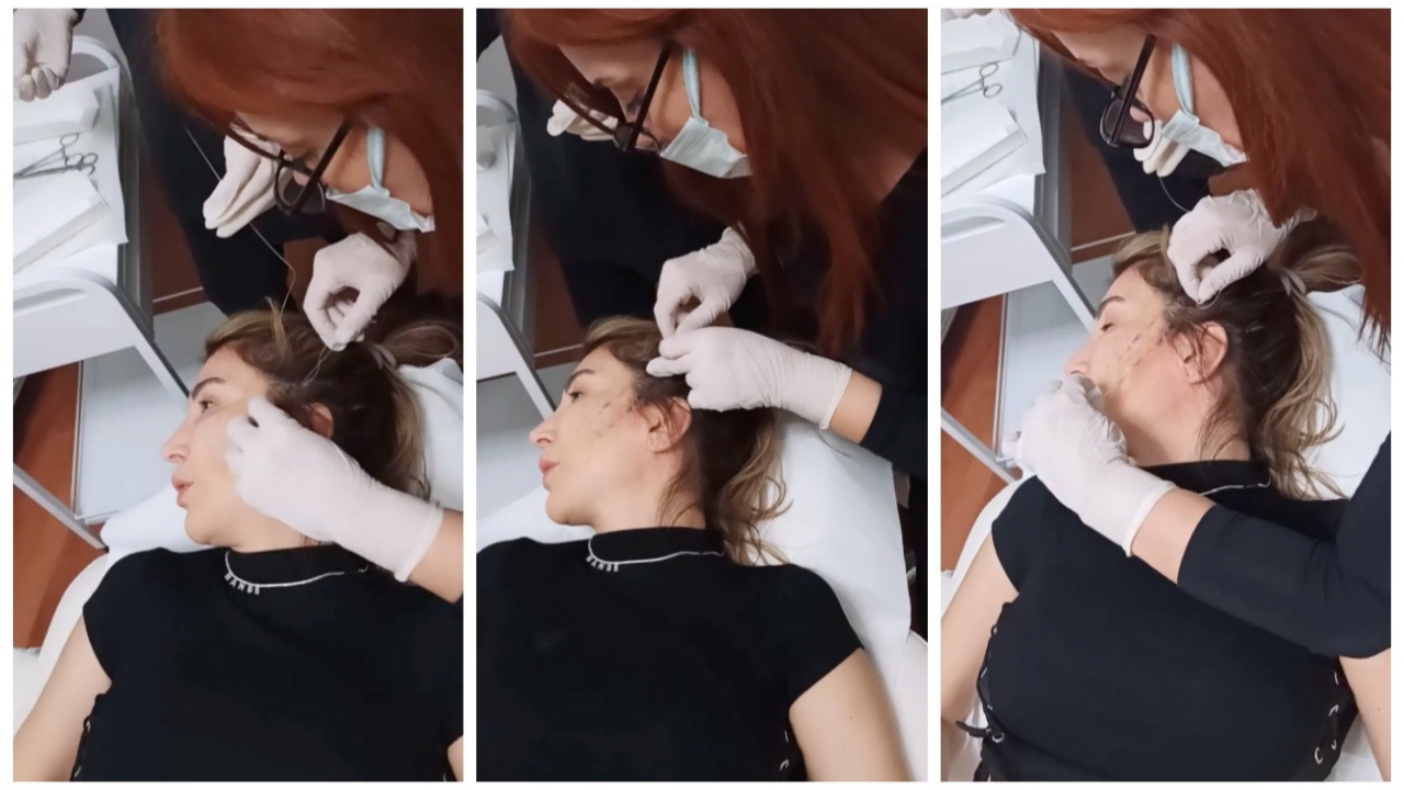 Şarkıcı Hande Yener estetik yaptırdığı anları yayınladı