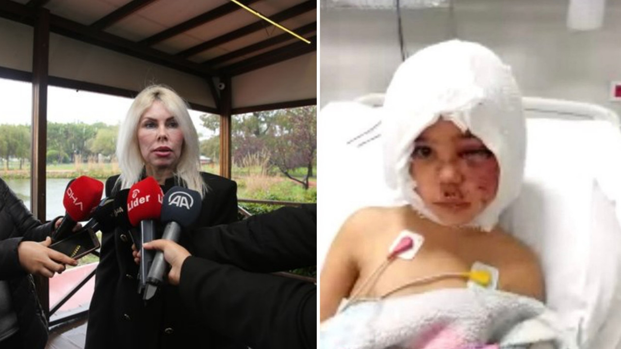 Pitbull saldırısına uğrayan Minik Asiye'den haber var: Yüz felci ameliyat ile geçecek!