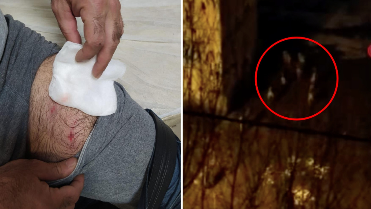Köpek sürüsü, evine giden adama saldırdı! Korku dolu anlar kamerada...