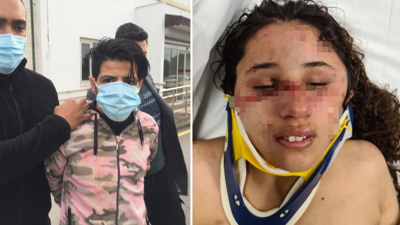 7 aylık hamile eşe akılalmaz işkence: İple bağlayıp vücudunda sigara söndürdü!